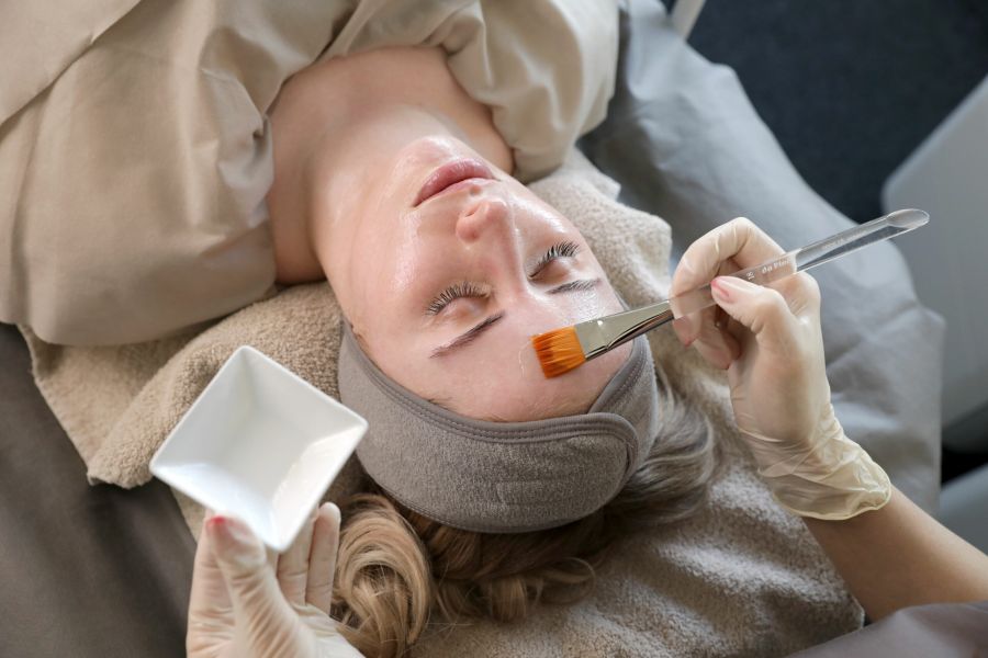 Active³ Peel Behandlung