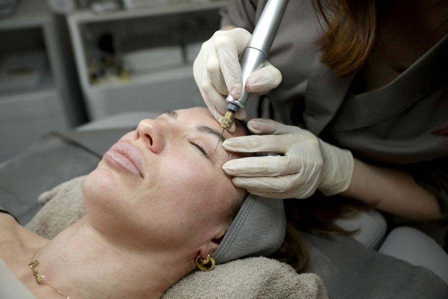 Purebeau Fibroblast Behandlung