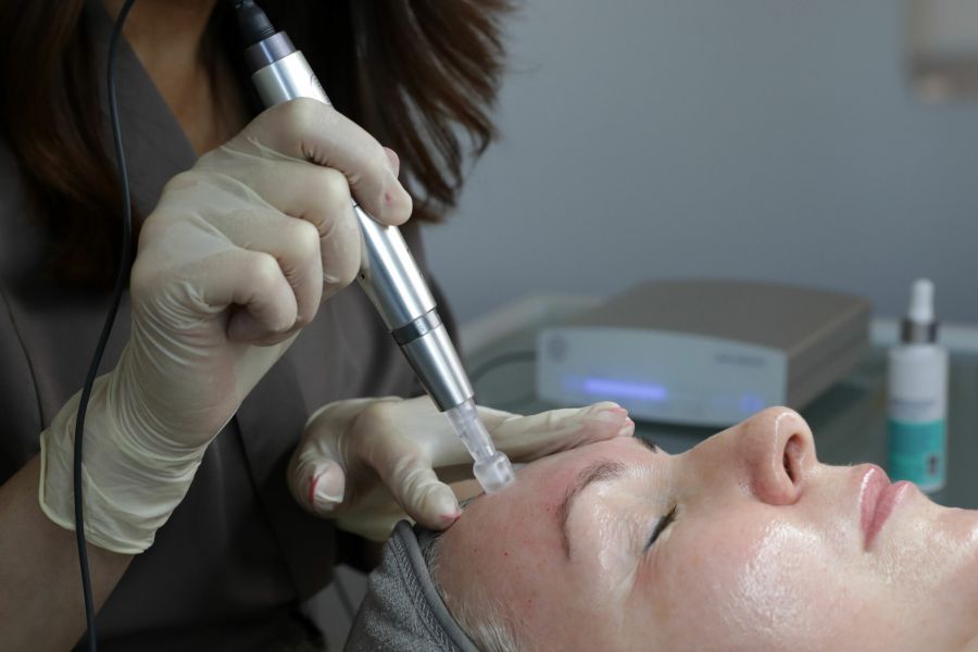 Collagen-Induktions-Therapie Behandlung